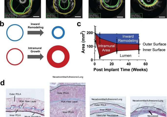 Tissue engineered vascular grafts transform into autologous neovessels with biomimetic function