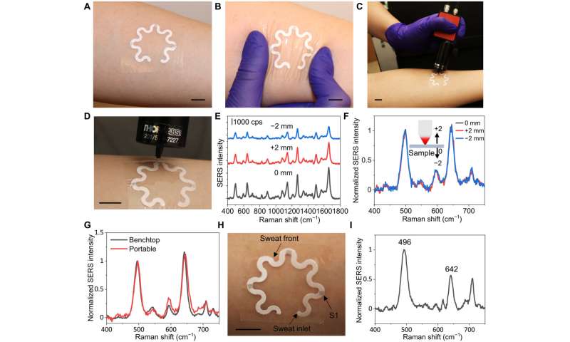 Wearable plasmonic paper-based microfluidics for sweat analysis