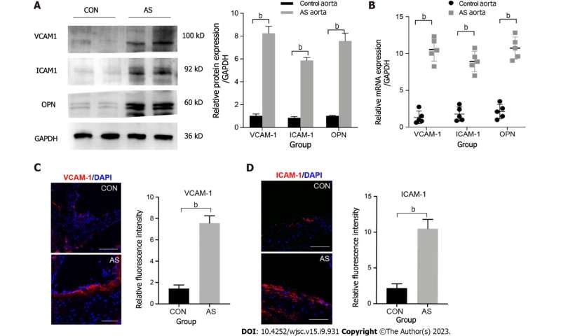 Integrin beta 3-overexpressing mesenchymal stromal cells display enhanced homing and can reduce atherosclerotic plaque