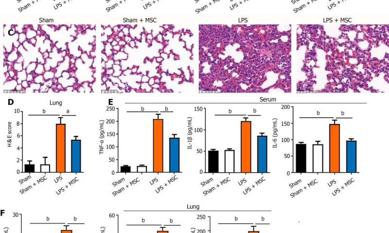 Multiomics reveal human umbilical cord mesenchymal stem cells improving acute lung injury via the lung-gut axis