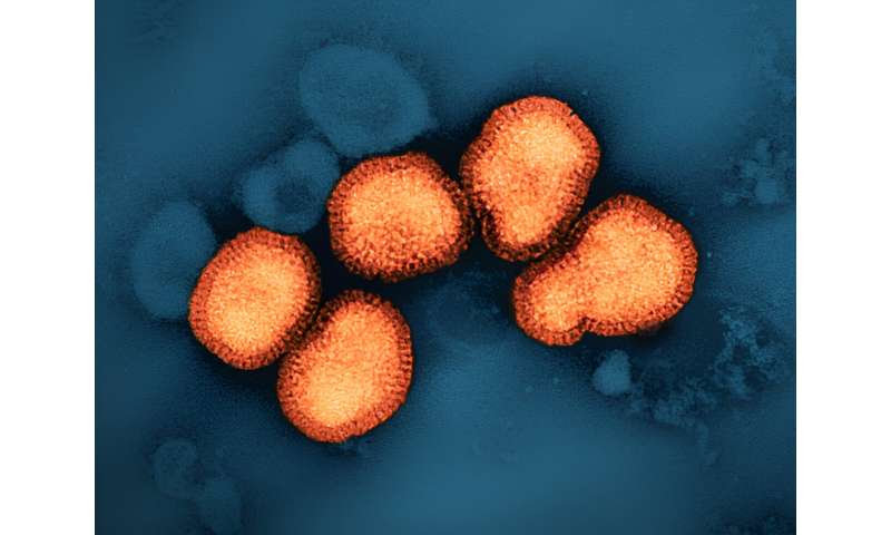 NIH clinical trial of universal flu vaccine candidate begins