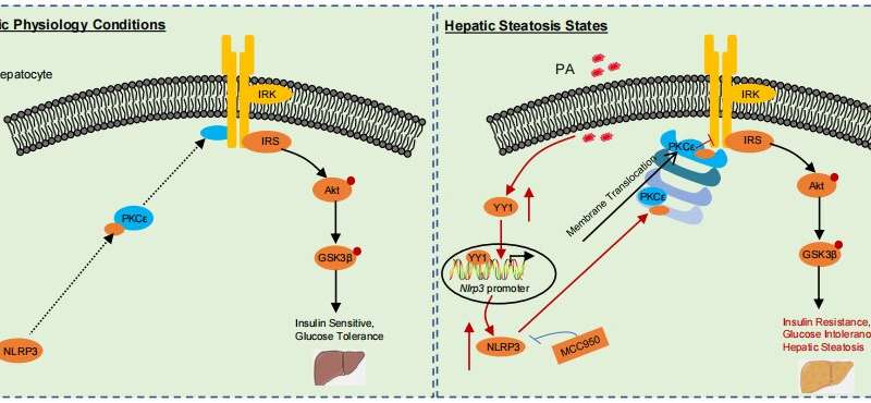 NLRP3 acts as a direct driver of hepatic insulin resistance