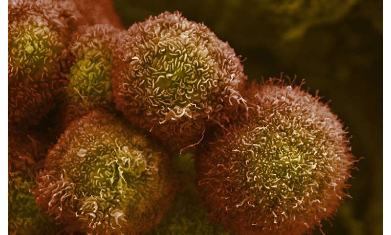 Pancreatic cancer therapy cleared for clinical trials
