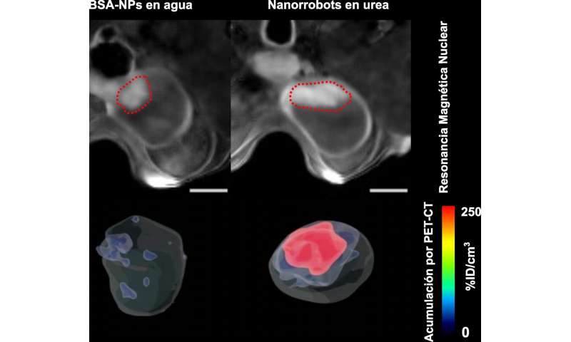 Bladder tumors reduced by 90% using nanorobots