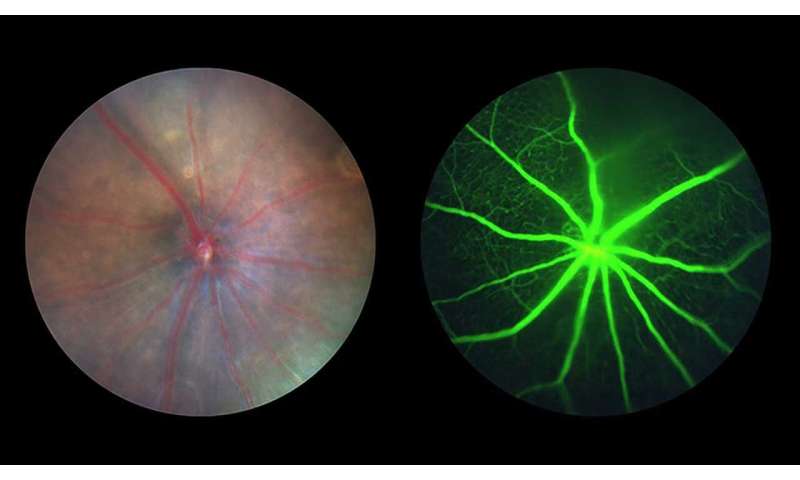 ISS National Lab-sponsored study tests a novel gene therapy for vision loss