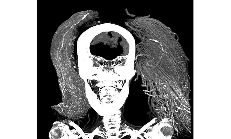 'Screaming Woman' mummy may have died in agony 3,500 years ago