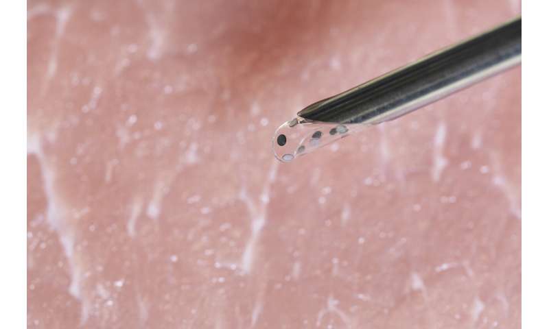 Shape-shifting ultrasound stickers detect post-surgical complications