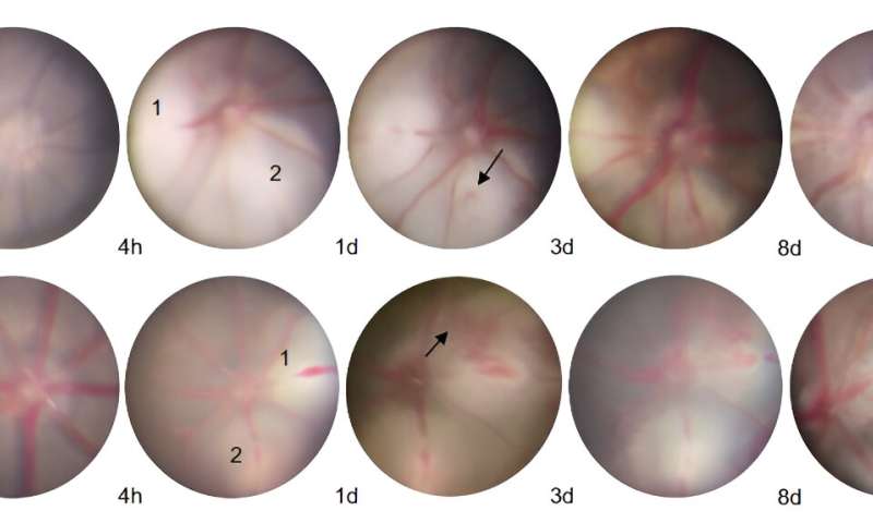 The Protective Effect of DNase I in Retinal Vein Occlusion