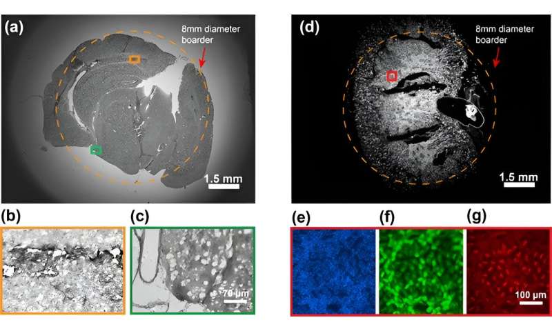 Wide-field, high-resolution and broadband mesoscopic objective lens