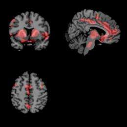 Brain imaging technique: New hope for understanding Parkinson's disease