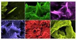 Cholesterol crystals incite inflammation in coronary arteries
