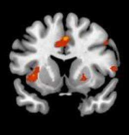 Frontal lobe of the brain is key to automatic responses to various stimuli, say scientists