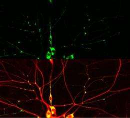 Key protein discovered that allows nerve cells to repair themselves