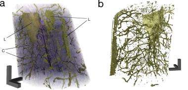 New computer-tomography method visualizes nano-structure of bones