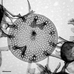 Reviving 100-year-old resting spores of diatoms