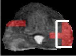 Rutgers researchers assess severity of prostate cancers using magnetic resonance imaging