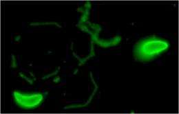 Scientists uncover process enabling toxoplasmosis parasite to survive homelessness
