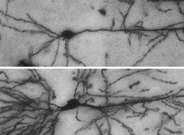 How nerve cells grow