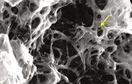 Carbon Nanotubes Boost Cancer-Fighting Cells