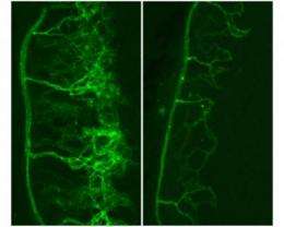 Scientists reveal new targets for anti-angiogenesis drugs