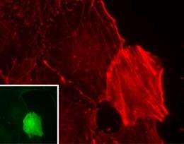 Tumor suppressor APC could stop cancer through its effect on actin cytoskeleton