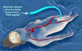 Wiring the Brain at the Nanoscale