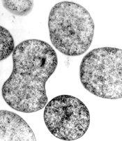 Pyrococcus furiosus, photographed by Henry Aldrich of the University of Florida.