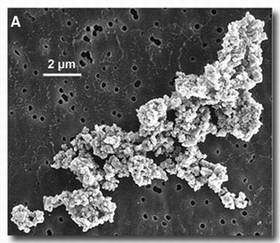 A secondary electron image of a typical chondritic Interplanetary Dust Particle