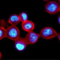 Human breast cancer cells tagged with quantum dots