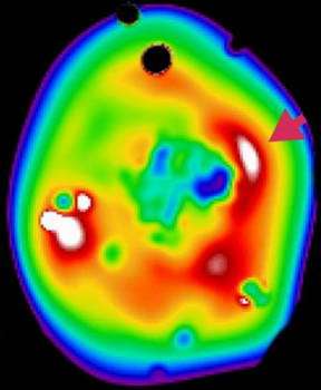 XMM-Newton probes formation of galaxy clusters
