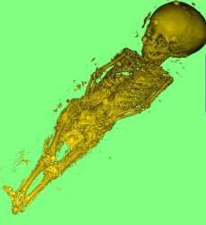 2,000-year-old mummy goes through 21st-century scanner