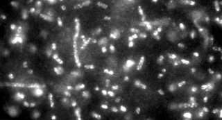 Quantum Dot Method Rapidly Identifies Bacteria