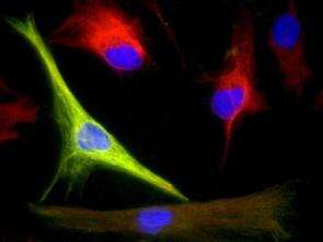 Common brain cells may have stem-cell-like potential