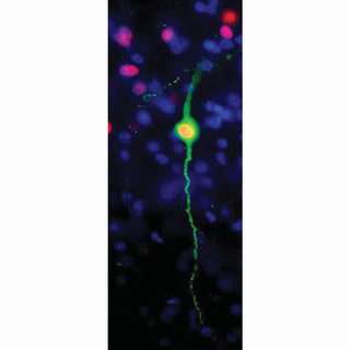 Groups and grumps: Study identifies 'sociality' neurons
