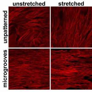 Stretching bone marrow stem cells pushes them towards becoming blood vessel