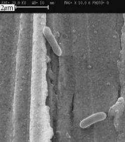 The protector: electron microscope image of MR-1 bacteria.