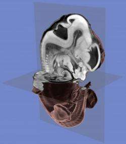 Embryos exposed in 3-D