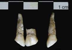 Excavated Teeth Study: Europeans may have imported slaves in the 1500s
