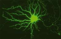How nerve cells stay in shape