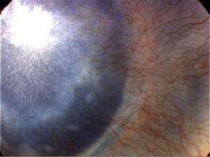 Eye research breakthrough yields new clues for treating diseases