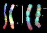 Human chromosomes revealed by RxFISH. Image credit: NASA/JSC.