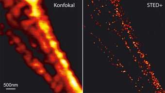 More Details in the Nanocosmos of the Cell