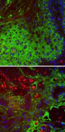 Balancing act protects vulnerable cells from cancer
