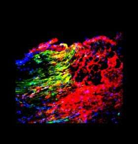 Blood clotting protein may inhibit spinal cord regeneration