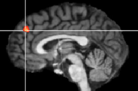 Area responsible for 'self-control' found in the human brain
