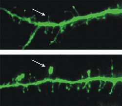 Hairstyle of a Neuron: From Hairy to Mushroom-Head