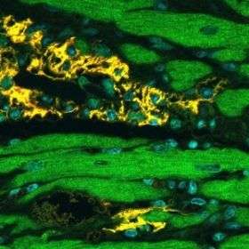 Human derived stem cells can repair rat hearts damaged by heart attack