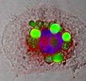 Macrophage Foam Cell