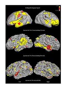 MIT model helps researchers 'see' brain development