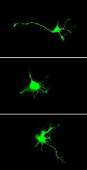Protein is linked to functional development of brain neurons